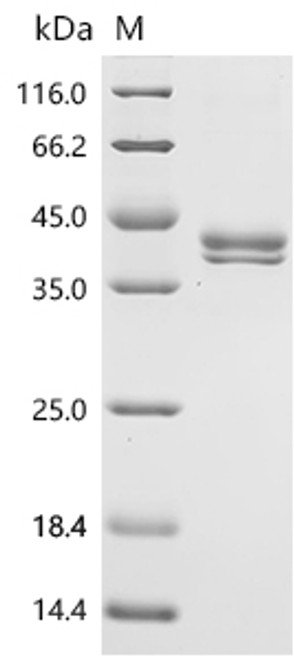 Recombinant Mouse Lymphocyte antigen 6E (Ly6e) (CSB-MP717533MO) Recombinant Mouse Lymphocyte antigen 6E (Ly6e) (CSB-MP717533MO)
