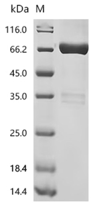 Recombinant Human Pro-neuregulin-1, membrane-bound isoform (NRG1), partial (CSB-MP016077HU) Recombinant Human Pro-neuregulin-1, membrane-bound isoform (NRG1), partial (CSB-MP016077HU)