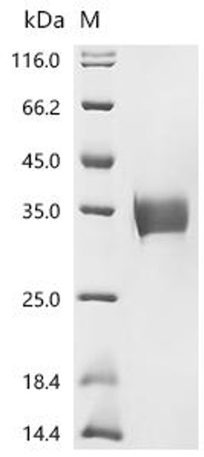 Recombinant Human Programmed cell death 1 ligand 1 (CD274), partial (CSB-MP878942HU1d7) Recombinant Human Programmed cell death 1 ligand 1 (CD274), partial (CSB-MP878942HU1d7)