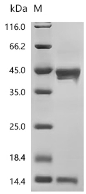 Recombinant Human Inhibin beta A chain (INHBA) (CSB-MP011719HU1) Recombinant Human Inhibin beta A chain (INHBA) (CSB-MP011719HU1)