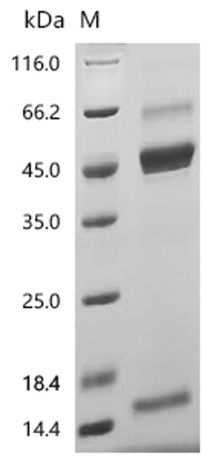 Recombinant Human Inhibin beta A chain (INHBA) (Active) (CSB-MP011719HU1b0) Recombinant Human Inhibin beta A chain (INHBA) (Active) (CSB-MP011719HU1b0)