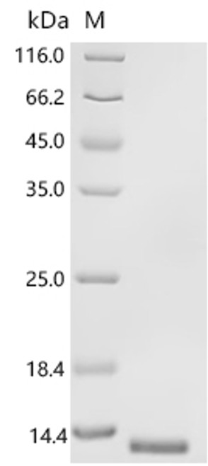 Recombinant Japanese encephalitis virus Envelope protein (E), partial (CSB-MP5209JAC2) Recombinant Japanese encephalitis virus Envelope protein (E), partial (CSB-MP5209JAC2)