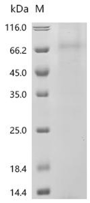 Recombinant Human 5-hydroxytryptamine receptor 3A (HTR3A), Biotinylated-Detergent (CSB-MP010890HU-B-D) Recombinant Human 5-hydroxytryptamine receptor 3A (HTR3A), Biotinylated-Detergent (CSB-MP010890HU-B-D)
