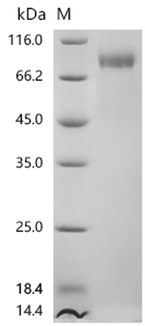 Recombinant Human MHC class I polypeptide-related sequence B (MICB), partial (CSB-MP013813HU) Recombinant Human MHC class I polypeptide-related sequence B (MICB), partial (CSB-MP013813HU)