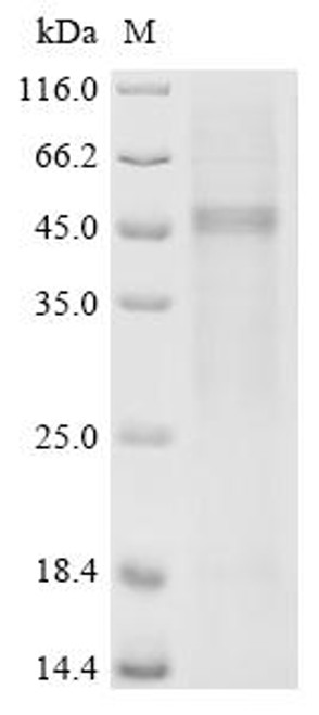Recombinant Human Vitamin K-dependent protein C(PROC) (CSB-MP018742HU(A4)) Recombinant Human Vitamin K-dependent protein C(PROC) (CSB-MP018742HU(A4))