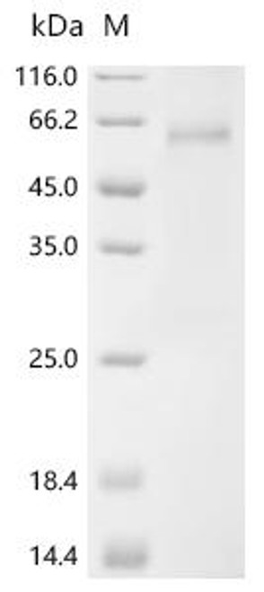 Recombinant Human Sushi repeat-containing protein SRPX2(SRPX2) (CSB-MP022690HU) Recombinant Human Sushi repeat-containing protein SRPX2(SRPX2) (CSB-MP022690HU)