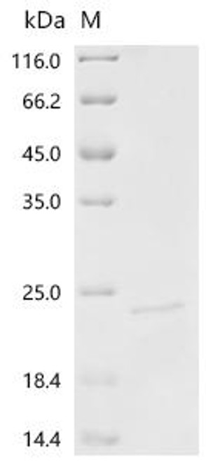 Recombinant Human Interleukin-36 gamma (IL36G), Biotinylated (CSB-MP873706HU1-B)