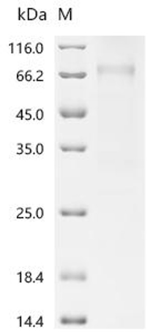 Recombinant Human Heterogeneous nuclear ribonucleoprotein H2 (IL36G) (CSB-MP346289HU) Recombinant Human Heterogeneous nuclear ribonucleoprotein H2 (IL36G) (CSB-MP346289HU)
