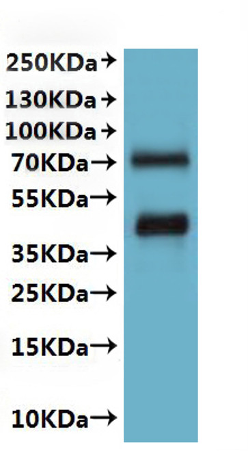 Recombinant Macaca fascicularis CX3C chemokine receptor 1 (CX3CR1)-VLPs (CSB-MP5452MOV)