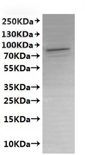 Recombinant Human Receptor-type tyrosine-protein phosphatase alpha (PTPRA)-VLPs (CSB-MP019047HUd7) Recombinant Human Receptor-type tyrosine-protein phosphatase alpha (PTPRA)-VLPs (CSB-MP019047HUd7)