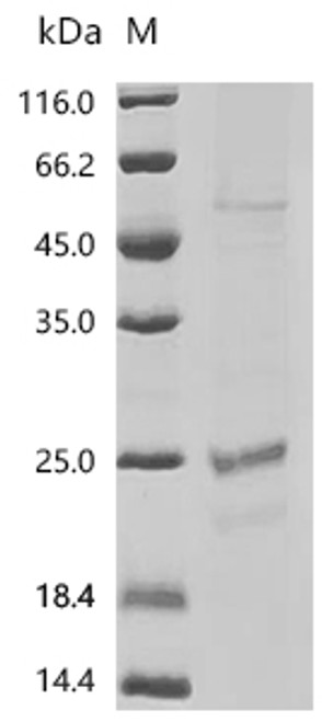 Recombinant Human Claudin-4 (CLDN4)-Detergent (CSB-MP005506HU-D)