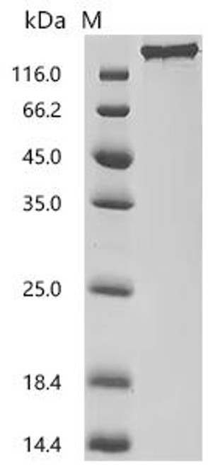 Recombinant Macaca fascicularis Seizure related 6 homolog (SEZ6), partial (Active) (CSB-MP6419MOV) Recombinant Macaca fascicularis Seizure related 6 homolog (SEZ6), partial (Active) (CSB-MP6419MOV)
