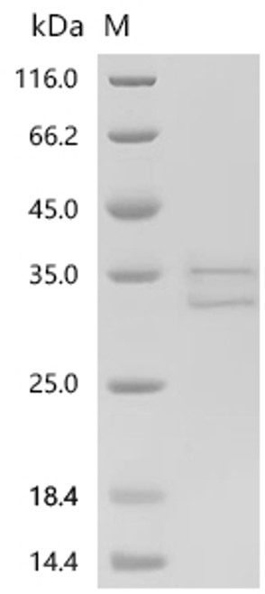 Recombinant Human Neutrophil elastase (ELANE), partial (CSB-MP007587HU1) Recombinant Human Neutrophil elastase (ELANE), partial (CSB-MP007587HU1)