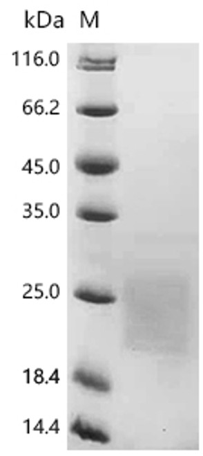 Recombinant Human Tumor necrosis factor receptor superfamily member 13B (TNFRSF13B), partial (CSB-MP023971HU1)