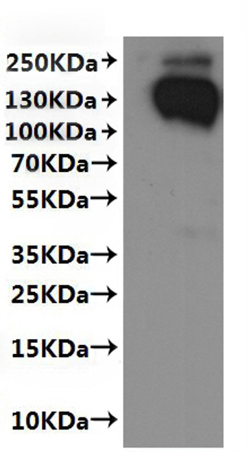 Recombinant Human Sodium-dependent phosphate transport protein 2B (SLC34A2)-VLPs (CSB-MP021581HU(F2)-C) Recombinant Human Sodium-dependent phosphate transport protein 2B (SLC34A2)-VLPs (CSB-MP021581HU(F2)-C)