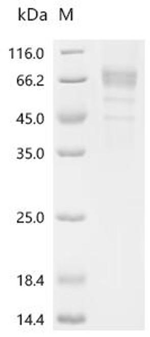 Recombinant Human Sodium-dependent phosphate transport protein 2B (SLC34A2), partial (CSB-MP021581HU1h8) Recombinant Human Sodium-dependent phosphate transport protein 2B (SLC34A2), partial (CSB-MP021581HU1h8)