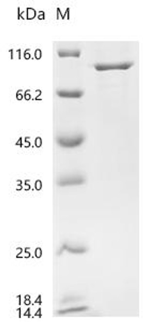 Recombinant Mouse Heat shock protein HSP 90-beta (Hsp90ab1) (CSB-MP010808MO) Recombinant Mouse Heat shock protein HSP 90-beta (Hsp90ab1) (CSB-MP010808MO)