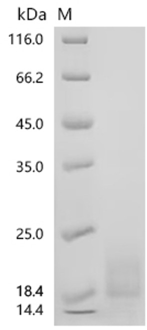 Recombinant Human Activin receptor type-1B (ACVR1B), partial (CSB-MP001258HU1) Recombinant Human Activin receptor type-1B (ACVR1B), partial (CSB-MP001258HU1)