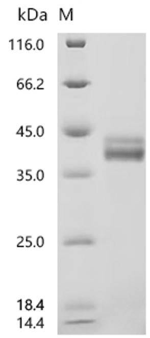 Recombinant Human C-C motif chemokine 17 (CCL17) (Active) (CSB-MP856406HU)