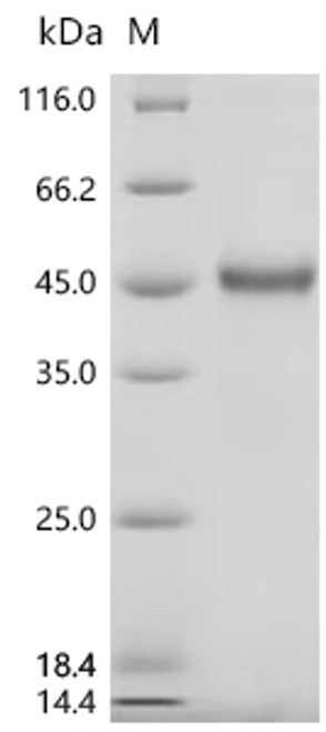 Recombinant Human Teratocarcinoma-derived growth factor 1 (TDGF1) (CSB-MP023343HU)