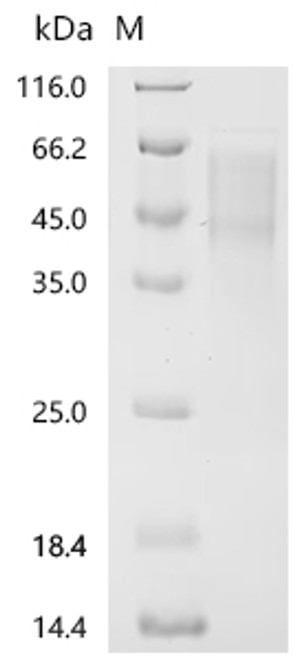 Recombinant MouseV-set domain containing T-cell activation inhibitor 1 (Vtcn1) (CSB-MP742524MO) Recombinant MouseV-set domain containing T-cell activation inhibitor 1 (Vtcn1) (CSB-MP742524MO)