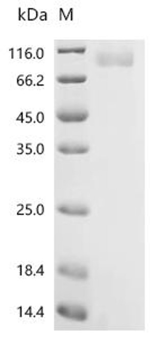 Recombinant Human Sodium/potassium-transporting ATPase subunit alpha-1 (ATP1A1), partial, Biotinylated (CSB-MP002322HU-B) Recombinant Human Sodium/potassium-transporting ATPase subunit alpha-1 (ATP1A1), partial, Biotinylated (CSB-MP002322HU-B)
