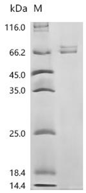 Recombinant Human Tumor necrosis factor receptor superfamily member 25 (TNFRSF25), partial (Active) (CSB-MP839000HUn6) Recombinant Human Tumor necrosis factor receptor superfamily member 25 (TNFRSF25), partial (Active) (CSB-MP839000HUn6)