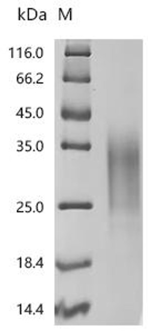Recombinant Human MHC class I chain-related molecule B (MICB), partial (Active) (CSB-MP5607HU1) Recombinant Human MHC class I chain-related molecule B (MICB), partial (Active) (CSB-MP5607HU1)