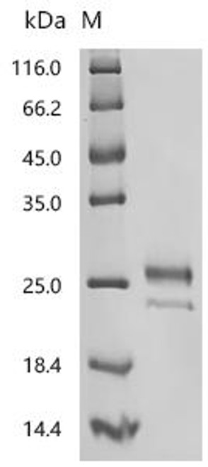 Recombinant Human MHC class I polypeptide-related sequence B (MICB), partial (CSB-MP5607HU2) Recombinant Human MHC class I polypeptide-related sequence B (MICB), partial (CSB-MP5607HU2)