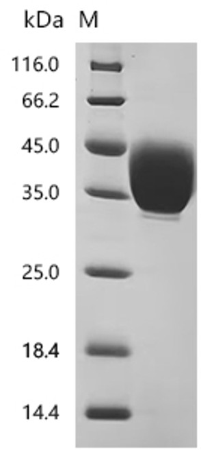 Recombinant Macaca fascicularis Tissue factor (F3), partial (Active) (CSB-MP6582MOV) Recombinant Macaca fascicularis Tissue factor (F3), partial (Active) (CSB-MP6582MOV)