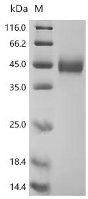 Recombinant Macaca fascicularis MHC class I polypeptide-related sequence B (MICB), partial (CSB-MP6584MOV)