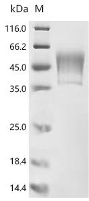 Recombinant Human Protein PBMUCL2 (HCG22) (CSB-MP522205HU) Recombinant Human Protein PBMUCL2 (HCG22) (CSB-MP522205HU)