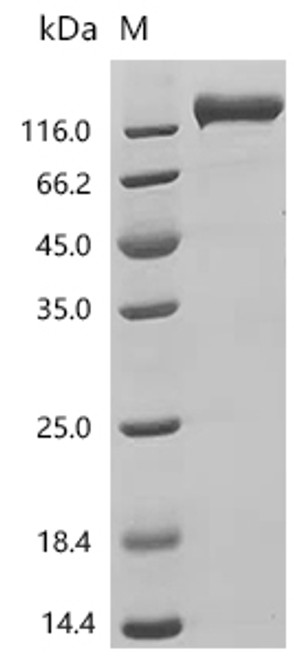 Recombinant Human Receptor-type tyrosine-protein phosphatase C (PTPRC), partial (Active) (CSB-MP019049HUc7) Recombinant Human Receptor-type tyrosine-protein phosphatase C (PTPRC), partial (Active) (CSB-MP019049HUc7)