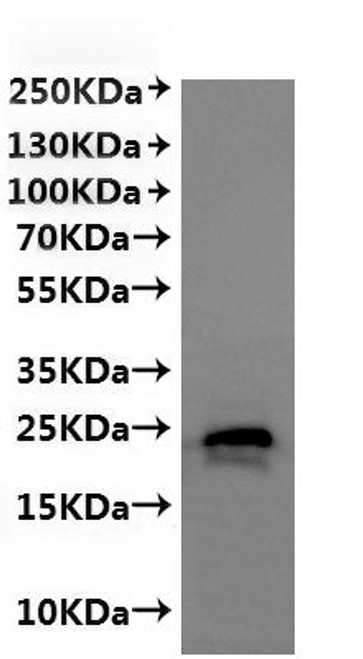 Recombinant Cucumis sativus Citrate transporter-like domain-containing protein, partial-VLPs (CSB-MP6057CXP1) Recombinant Cucumis sativus Citrate transporter-like domain-containing protein, partial-VLPs (CSB-MP6057CXP1)