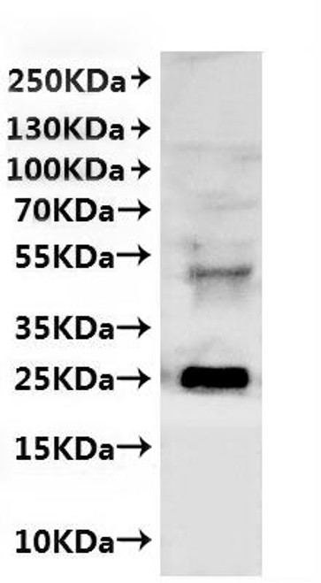 Recombinant Oryza glumipatula Citrate transporter-like domain-containing protein-VLPs (CSB-MP6061GYI) Recombinant Oryza glumipatula Citrate transporter-like domain-containing protein-VLPs (CSB-MP6061GYI)