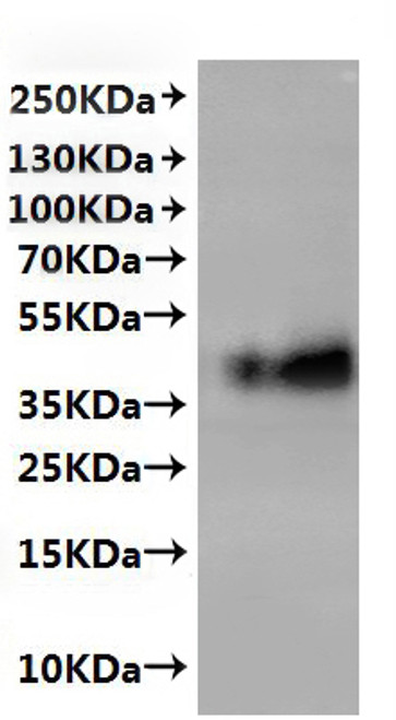 Recombinant Mouse C-C chemokine receptor type 5(Ccr5)-VLPs (CSB-MP004844MO(A4))
