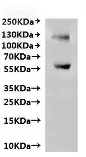 Recombinant Human Probable G-protein coupled receptor 75 (GPR75)-VLPs (CSB-MP009829HU(A4)m8) Recombinant Human Probable G-protein coupled receptor 75 (GPR75)-VLPs (CSB-MP009829HU(A4)m8)