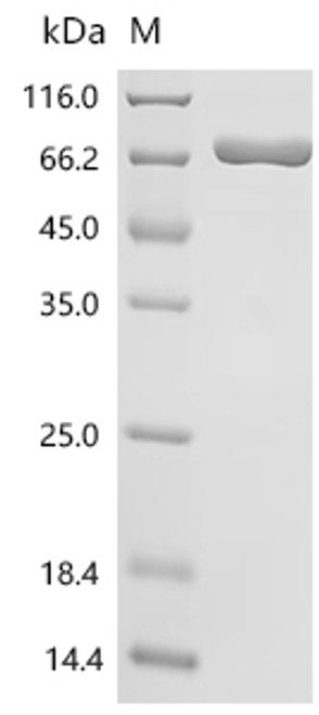 Recombinant Human Protein-arginine deiminase type-1 (PADI1) (CSB-MP891543HU) Recombinant Human Protein-arginine deiminase type-1 (PADI1) (CSB-MP891543HU)