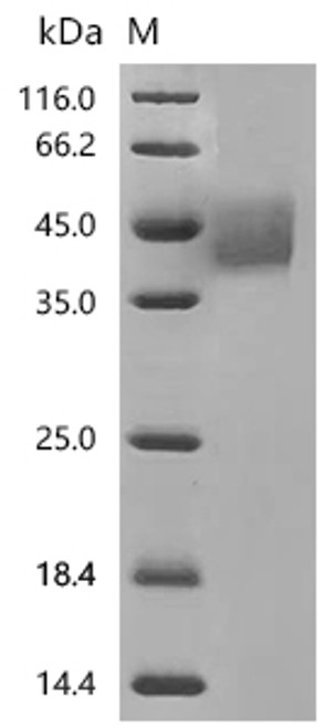Recombinant Mouse Tumor-associated calcium signal transducer 2 (Tacstd2), partial (CSB-MP023072MO) Recombinant Mouse Tumor-associated calcium signal transducer 2 (Tacstd2), partial (CSB-MP023072MO)