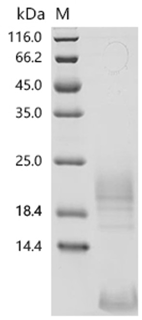 Recombinant Macaca fascicularis Thymic stromal lymphopoietin (TSLP) (Active) (CSB-MP5042MOVd7)