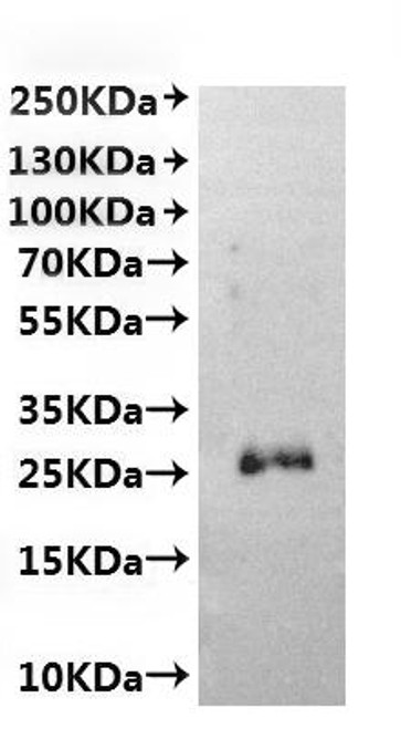 Recombinant Hepatitis B virus genotype C subtype adr Large envelope protein (S)-VLPs (CSB-MP800387HEAA(F2))