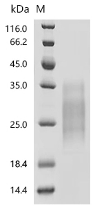 Recombinant Mouse Kit ligand (Kitlg), partial (Active) (CSB-MP012376MO1)
