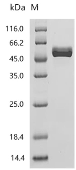 Recombinant Human T-cell surface glycoprotein CD4 (CD4), partial (Active) (CSB-MP004935HU1)