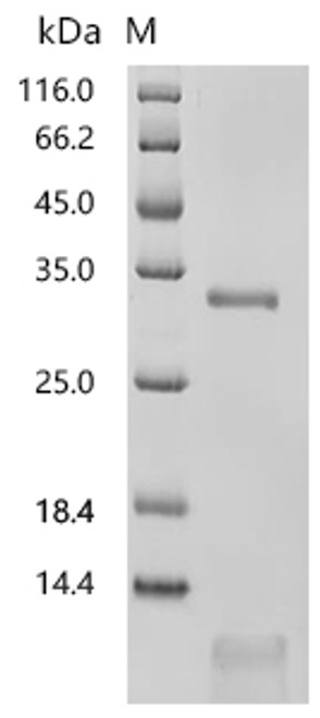 Recombinant Human Procathepsin L (CTSL) (Active) (CSB-MP006193HU(A4))