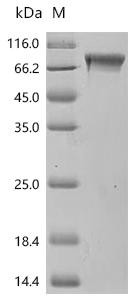 Recombinant Macaca mulatta Coagulation factor IX (F9) (CSB-MP6650MOW)