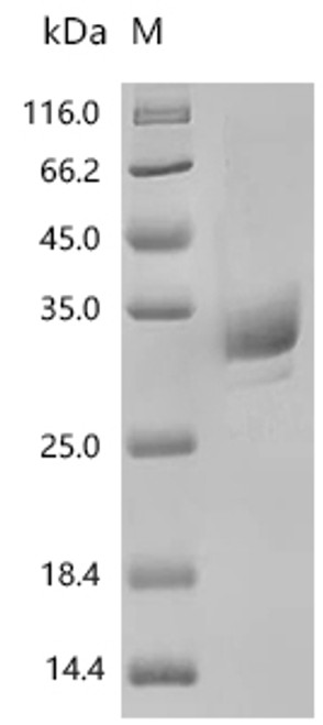 Recombinant Human Angiopoietin-1 (ANGPT1), partial (CSB-MP622996HU1)