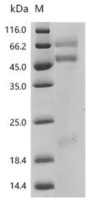 Recombinant Macaca mulatta Coagulation factor X (F10) (CSB-MP6651MOW)