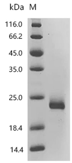 Recombinant Human Interleukin-4 (IL4), Biotinylated (CSB-MP011659HUd7-B)