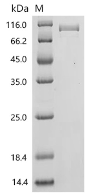 Recombinant Human Growth/differentiation factor 9 (GDF9) (CSB-MP009352HUp2)