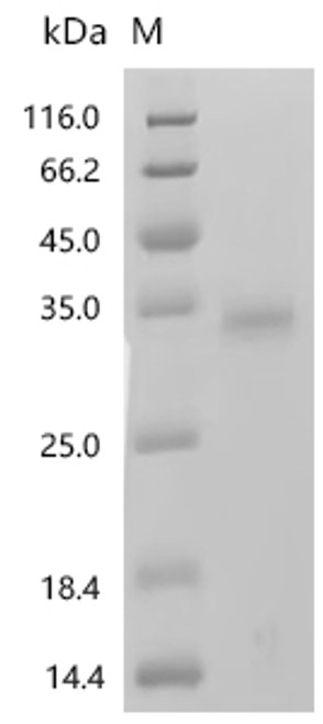 Recombinant Bovine Insulin-like growth factor 2 (IGF2) (CSB-MP011088BO)